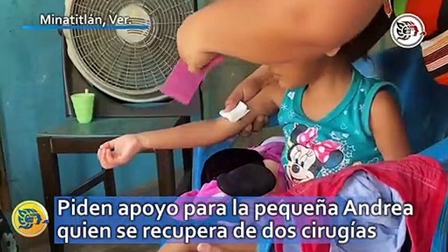 Piden apoyo para la pequeña Andrea de 3 años quien se recupera de dos cirugías en menos de una semana