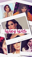 سارة الودعاني قبل وبعد تجميل الأنف والعيون