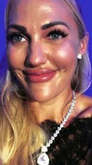 نجمات تركيا قبل وبعد عمليات تجميل إحداهن اختلفت 180 درجة