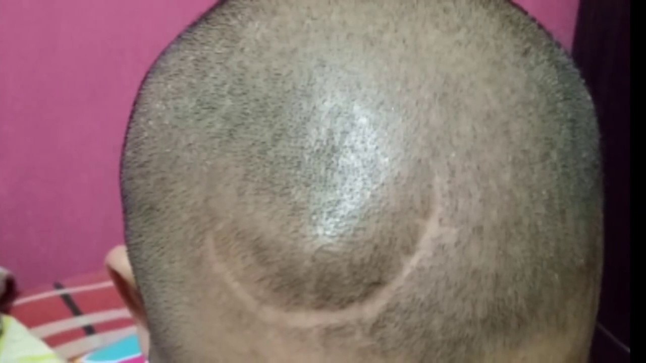 cinta sesungguh nya istri nya mengalami kanker otak - penantian suami