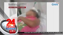 Gunting na tumusok sa ulo ng batang 8-anyos, naalis matapos maoperahan | 24 Oras Weekend