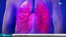 Nuevo tratamiento español eleva un 20% la supervivencia de los pacientes con cáncer de pulmón | La buena noticia