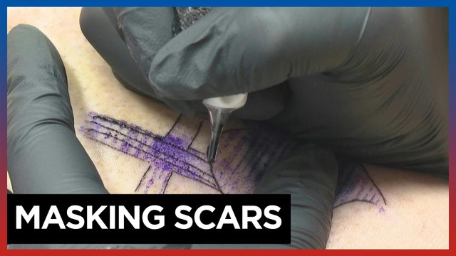 Tattoos conceal US sex-trafficking survivors' painful past