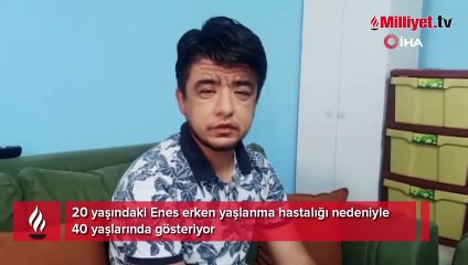 Gerçekte 20 yaşında, 40 yaşında gibi gösteriyor