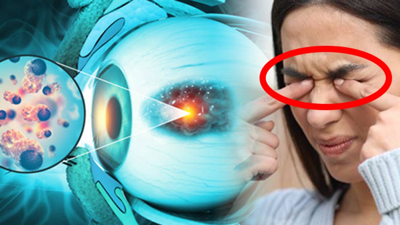 Eye Itching होना Eye Herpes Symptoms, क्या है Reason और कैसे लें Precautions | Boldsky