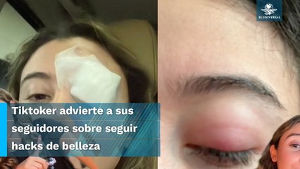 Termina en el quirófano por probar un truco de belleza