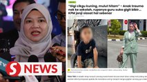 Biting incident: We are waiting for probe results over claims, says Fadhlina