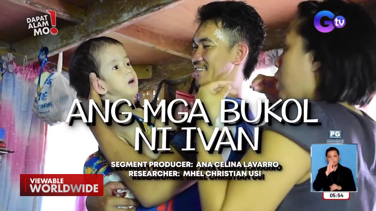 Bata, ipinanganak na may hydrocephalus at bukol sa kanyang spinal cord! | Dapat Alam Mo!