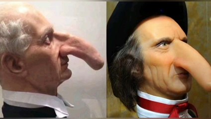 Manusia Dengan Hidung Terpanjang Dunia