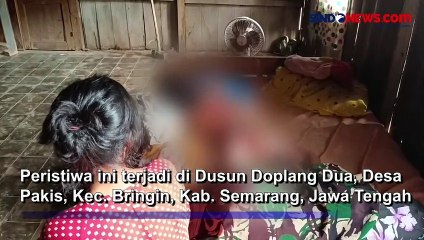 Miris, Bocah 8 Tahun Diduga Dibakar Temannya saat Akan ke Warung