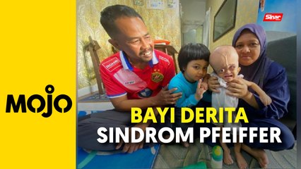 Suami isteri risau kepala bayi membesar, wajah berubah