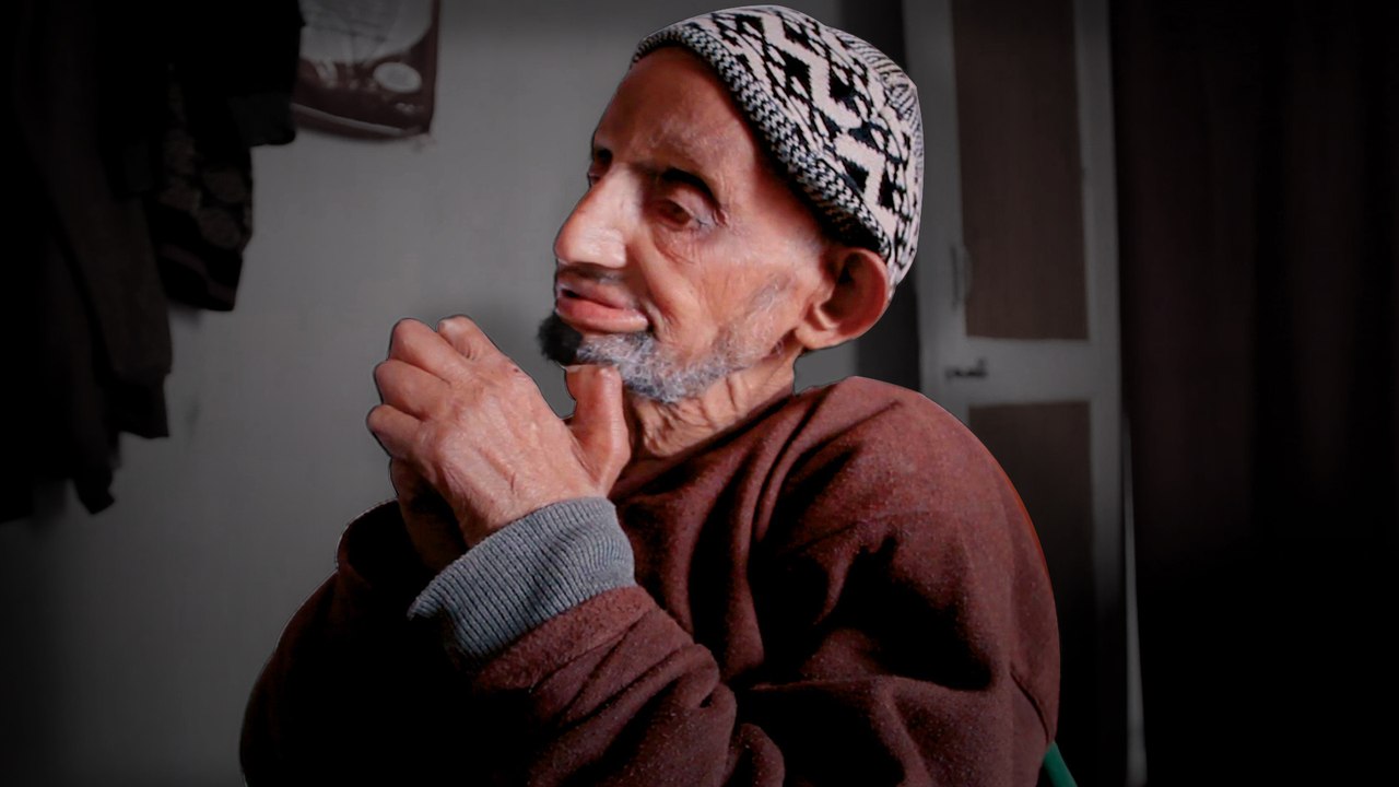 Once called 'untouchable', leprosy survivors in India build communities after society shunned them