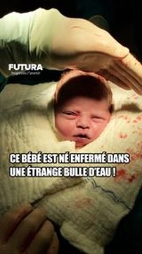 Pourquoi ce bébé est-il née dans une « bulle d'eau » ? #science