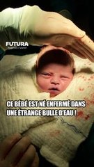 Pourquoi ce bébé est-il née dans une « bulle d'eau » ? #science