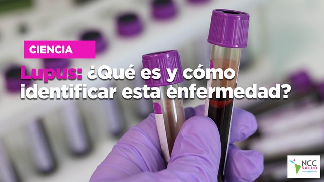 Lupus: ¿Qué es y cómo identificar esta enfermedad?