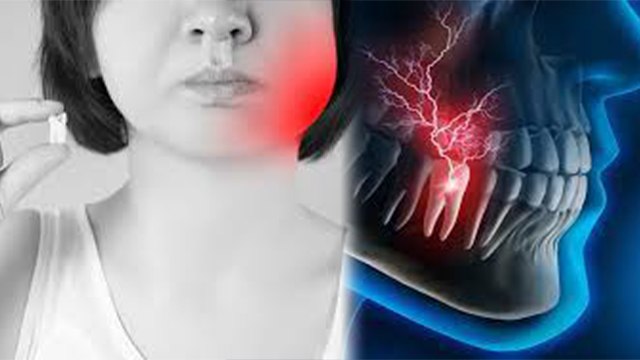 Root Canal Ke Bad Dant Me Dard Kyu Hota Hai | रूट कैनाल के बाद दांत दर्द क्यों होता है | Boldsky