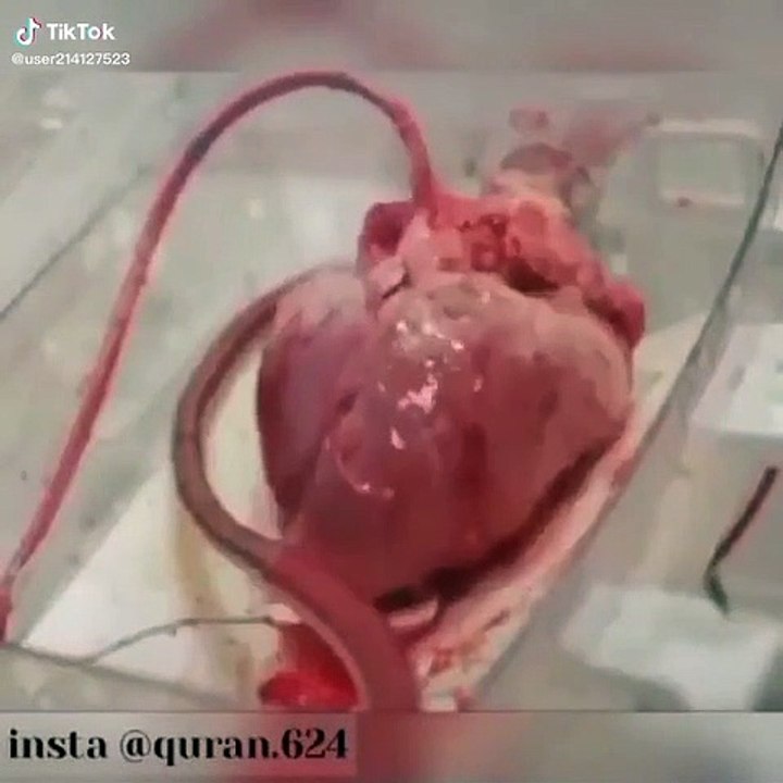 A heart beating outside the body