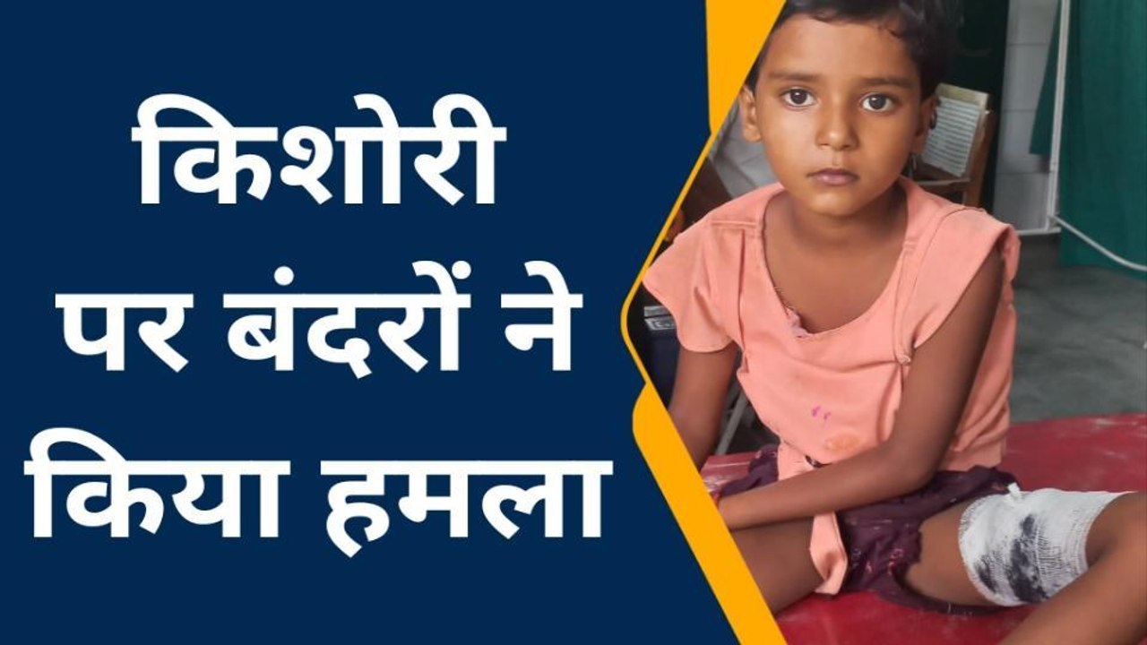 रामपुर: बंदरों के झुंड ने किशोरी पर किया हमला, सीएचसी में भर्ती