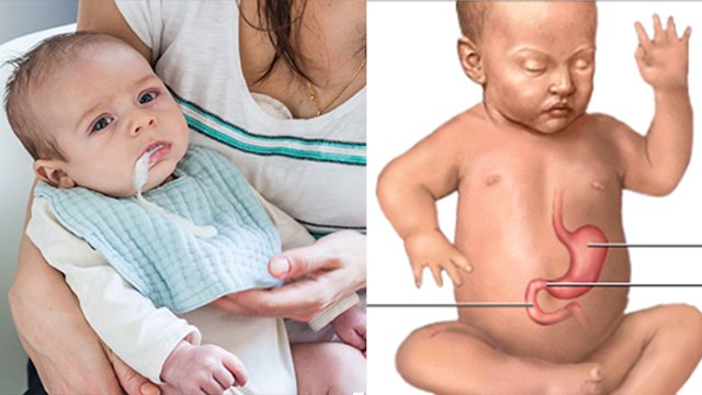 बच्चा दूध पीने के बाद उल्टी क्यों करता है | Baccha Dudh Pine Ke Bad Ulti Kyon Karta Hai | Boldsky