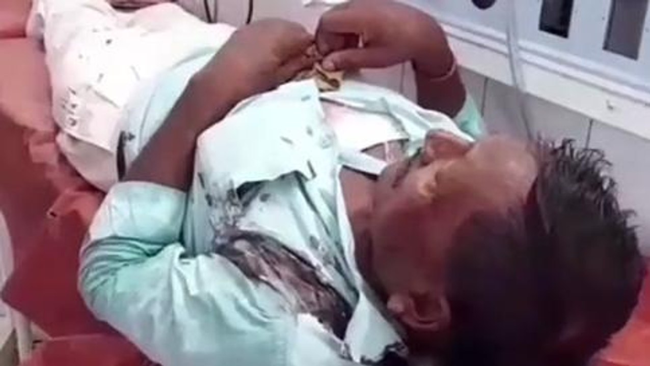 जमुई में बदमाश ने हवलदार को पिस्टल की बट से मारकर किया घायल, अस्पताल में भर्ती