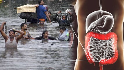 बारिश के पानी से इस गंभीर बीमारी का खतरा, लक्षण और कारण जानना जरूरी | Boldsky