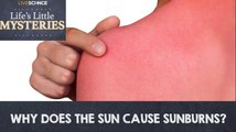 Why Does the Sun Cause Sunburns?
