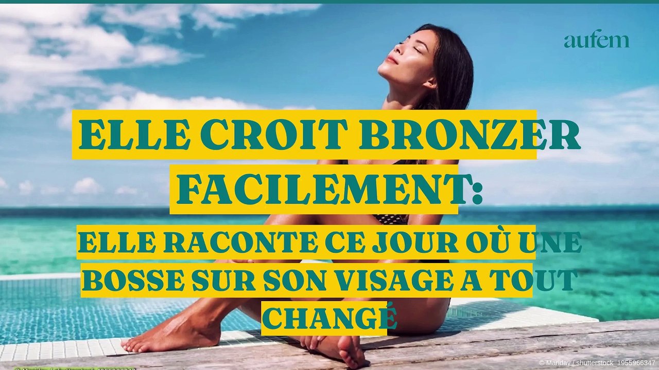 Elle croit bronzer facilement : elle raconte ce jour où une bosse sur son visage a tout changé