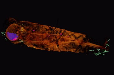 Roman-Era Child Mummy's Secrets Revealed