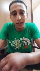 "إسلام" شاب فقد ذراعه ومهدد ببتر الثانى بسبب مرض نادر.. والصحة تتدخل لعلاجه