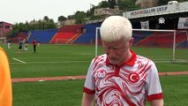 MARDİN - Azmiyle engelini aşan albino milli atlet, yeni hedeflere odaklandı