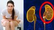 Kidney Stone से Kidney Damage हो सकती है क्या | Does Kidney Stone Causes Kidney Damage | Boldsky