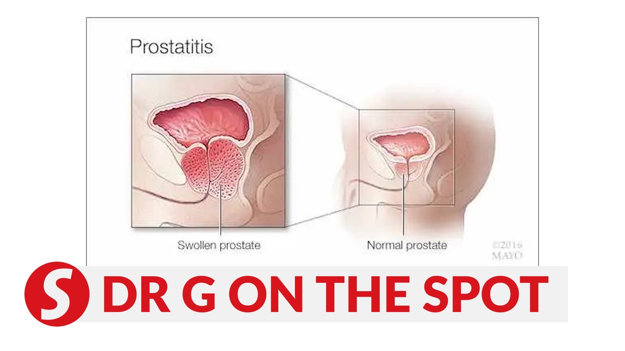 EP181: Prostatitis dampening sexual performance | PUTTING DR G ON THE SPOT