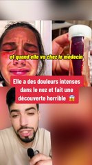 Elle a mal au nez et fait une découverte horrible !