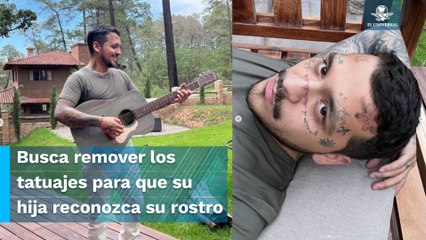 Nodal comparte cómo luce su rostro tras iniciar tratamiento para la eliminación de tattoos