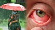 Pink Eye Infection क्या है, Delhi Flood के बाद Eye Conjunctivitis Symptoms कैसे पहचाने | Boldsky