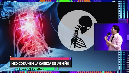 Médicos unen la cabeza de un niño