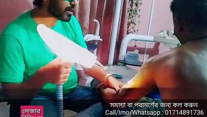 লেজার করে ট্যাটু রিমুভ করা হচ্ছে | বিস্তারিত ভিডিওতে দেখুন