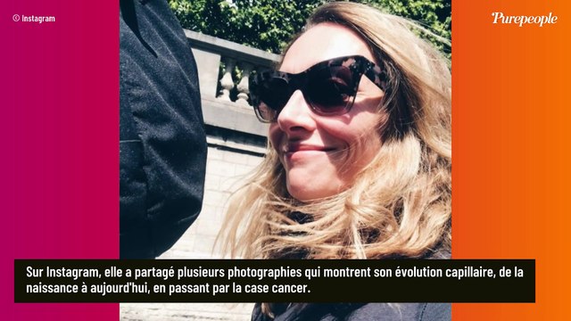PHOTOS Laurie Delhostal atteinte d'un cancer du sein, ses cheveux repoussent de façon étrange