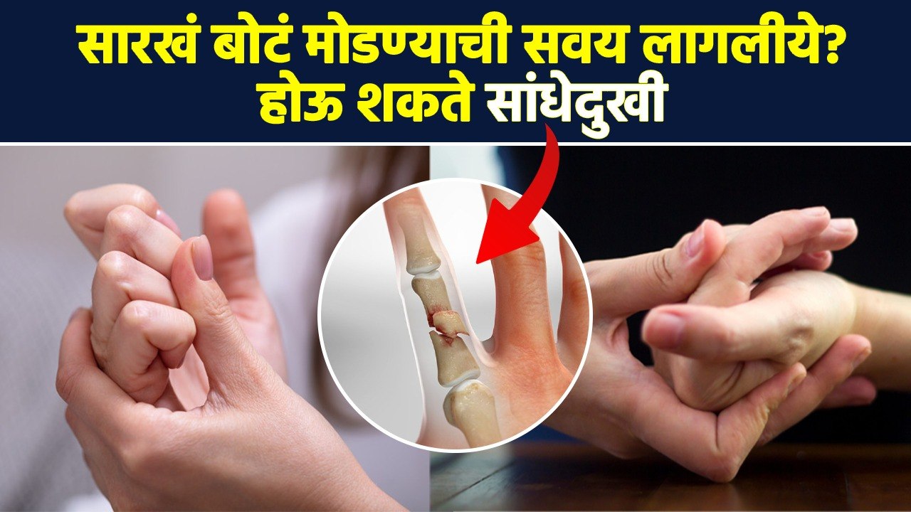 बोटं मोडण्याची सवय चांगली की वाईट ? | Does Cracking Knuckles Cause Arthritis | RI3