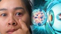 आई फ्लू से अंधेपन का कितना खतरा | Eye Flu Se Andhepan Ka Kitna Khatra | Eye Flu Treatment in Hindi