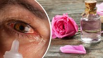 आई फ्लू होने पर गुलाब जल डालना सही या गलत | Eye Flu Hone Par Gulab Jal Dalna Sahi Ya Galat | Boldsky