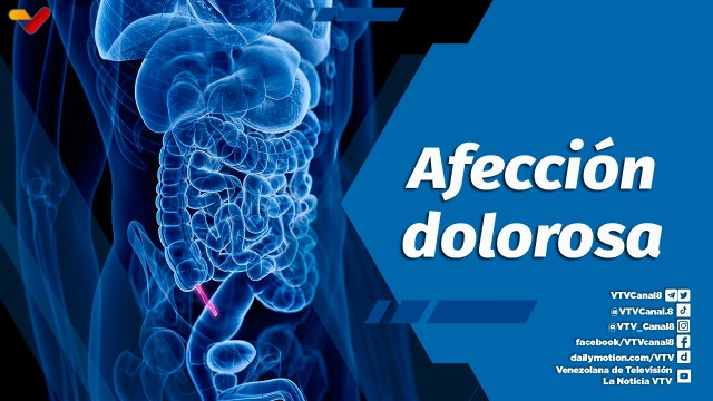 Actitud Saludable | ¿Qué función tiene el apéndice y cuál es su causa?