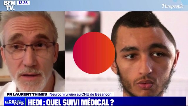 Un parpaing sur la tête : Hedi tête déformée par un tir de LBD, détails glaçants sur sa blessure et ses conséquences