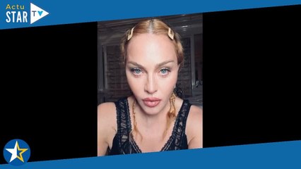 Madonna admise en soins intensifs : retour sensuel en top transparent, la chanteuse veut rassurer !