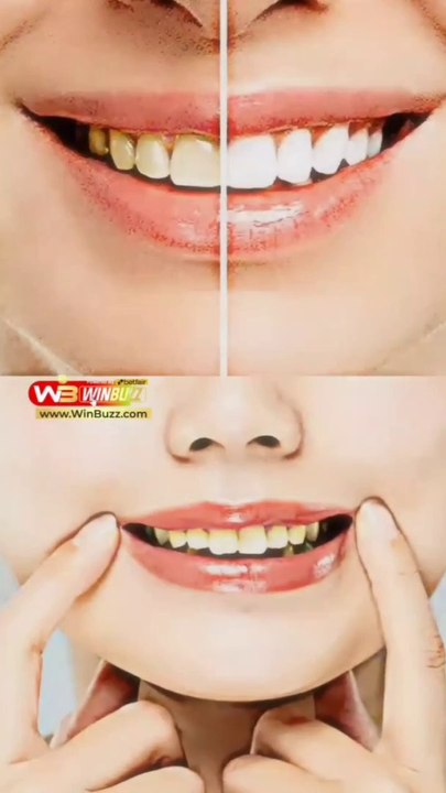 %E0%A4%AA%E0%A5%80%E0%A4%B2%E0%A5%87_%E0%A4%A6%E0%A4%BE%E0%A4%82%E0%A4%A4%E0%A5%8B%E0%A4%82_%E0%A4%95%E0%A4%BE_%E0%A4%B8%E0%A4%B0%E0%A4%B2_%E0%A4%89%E0%A4%AA%E0%A4%BE%E0%A4%AF_%F0%9F%A4%94_._._FOLLOW_-__%40sanatani.abhay_%F0%9F%91