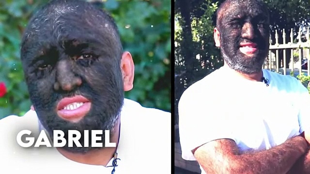 People With Rarest Features That No one Was Supposed To Have - video ...