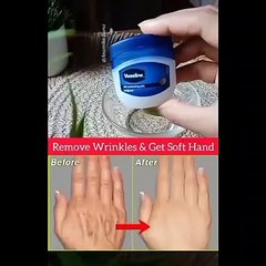 wrinkles free fair beautiful hands #short #shortsfeed #youtubeshorts  #viralshorts  #viralvideo