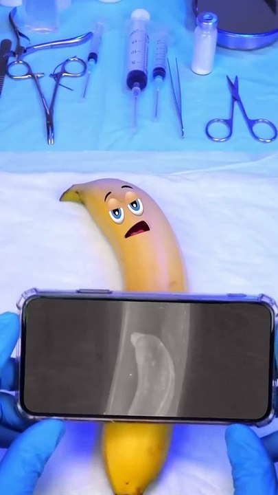 Banana  Delivery Operation