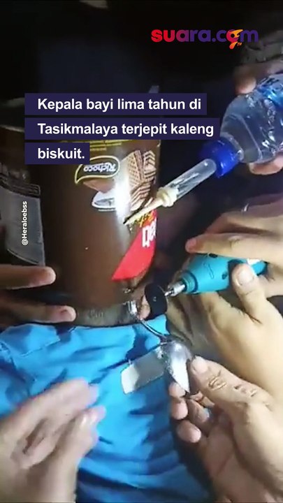 Aksi Heroik Damkar Selamatkan Balita yang Kepalanya Terjepit Kaleng Biskuit