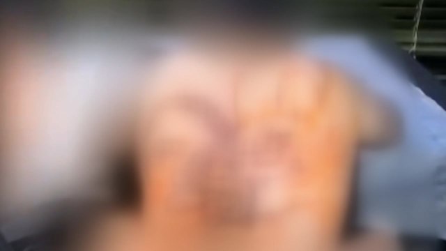 '조폭 문신' 불법 시술한 업자 12명 불구속 기소 / YTN